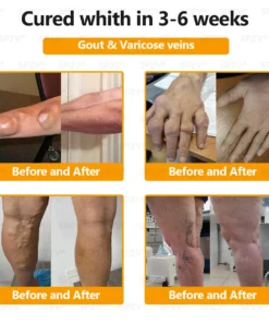 𝐒𝐩𝐳𝐯® 𝐁𝐞𝐞 𝐕𝐞𝐧𝐨𝐦 𝐏𝐚𝐢𝐧-𝐑𝐞𝐥𝐢𝐞𝐟 𝐁𝐨𝐧𝐞 𝐇𝐞𝐚𝐥𝐢𝐧𝐠 𝐂𝐫𝐞𝐚𝐦