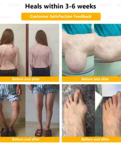 𝐒𝐩𝐳𝐯® 𝐁𝐞𝐞 𝐕𝐞𝐧𝐨𝐦 𝐏𝐚𝐢𝐧-𝐑𝐞𝐥𝐢𝐞𝐟 𝐁𝐨𝐧𝐞 𝐇𝐞𝐚𝐥𝐢𝐧𝐠 𝐂𝐫𝐞𝐚𝐦