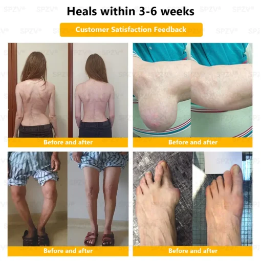 𝐒𝐩𝐳𝐯® 𝐁𝐞𝐞 𝐕𝐞𝐧𝐨𝐦 𝐏𝐚𝐢𝐧-𝐑𝐞𝐥𝐢𝐞𝐟 𝐁𝐨𝐧𝐞 𝐇𝐞𝐚𝐥𝐢𝐧𝐠 𝐂𝐫𝐞𝐚𝐦