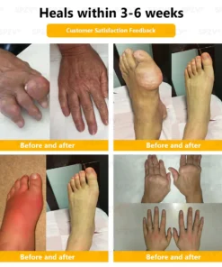 𝐒𝐩𝐳𝐯® 𝐁𝐞𝐞 𝐕𝐞𝐧𝐨𝐦 𝐏𝐚𝐢𝐧-𝐑𝐞𝐥𝐢𝐞𝐟 𝐁𝐨𝐧𝐞 𝐇𝐞𝐚𝐥𝐢𝐧𝐠 𝐂𝐫𝐞𝐚𝐦