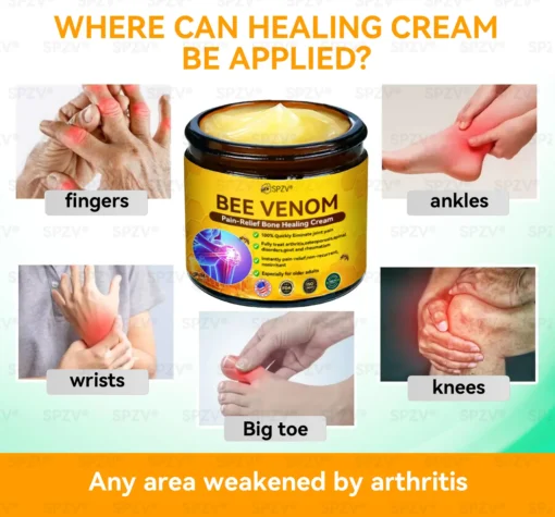 𝐒𝐩𝐳𝐯® 𝐁𝐞𝐞 𝐕𝐞𝐧𝐨𝐦 𝐏𝐚𝐢𝐧-𝐑𝐞𝐥𝐢𝐞𝐟 𝐁𝐨𝐧𝐞 𝐇𝐞𝐚𝐥𝐢𝐧𝐠 𝐂𝐫𝐞𝐚𝐦