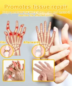 Spzv® Botulinum Toxin & Bee Venom Pain-Relief Bone Healing Cream
