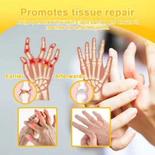 Spzv® Botulinum Toxin & Bee Venom Pain-Relief Bone Healing Cream