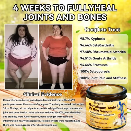 Spzv® Botulinum Toxin & Bee Venom Pain-Relief Bone Healing Cream