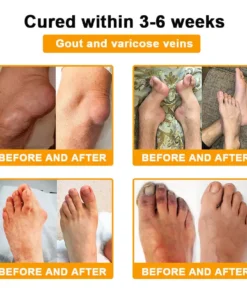 Spzv® Botulinum Toxin & Bee Venom Pain-Relief Bone Healing Cream